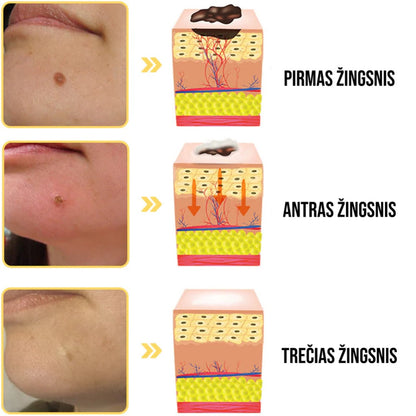 Bišu indes ārstēšanas aerosols 