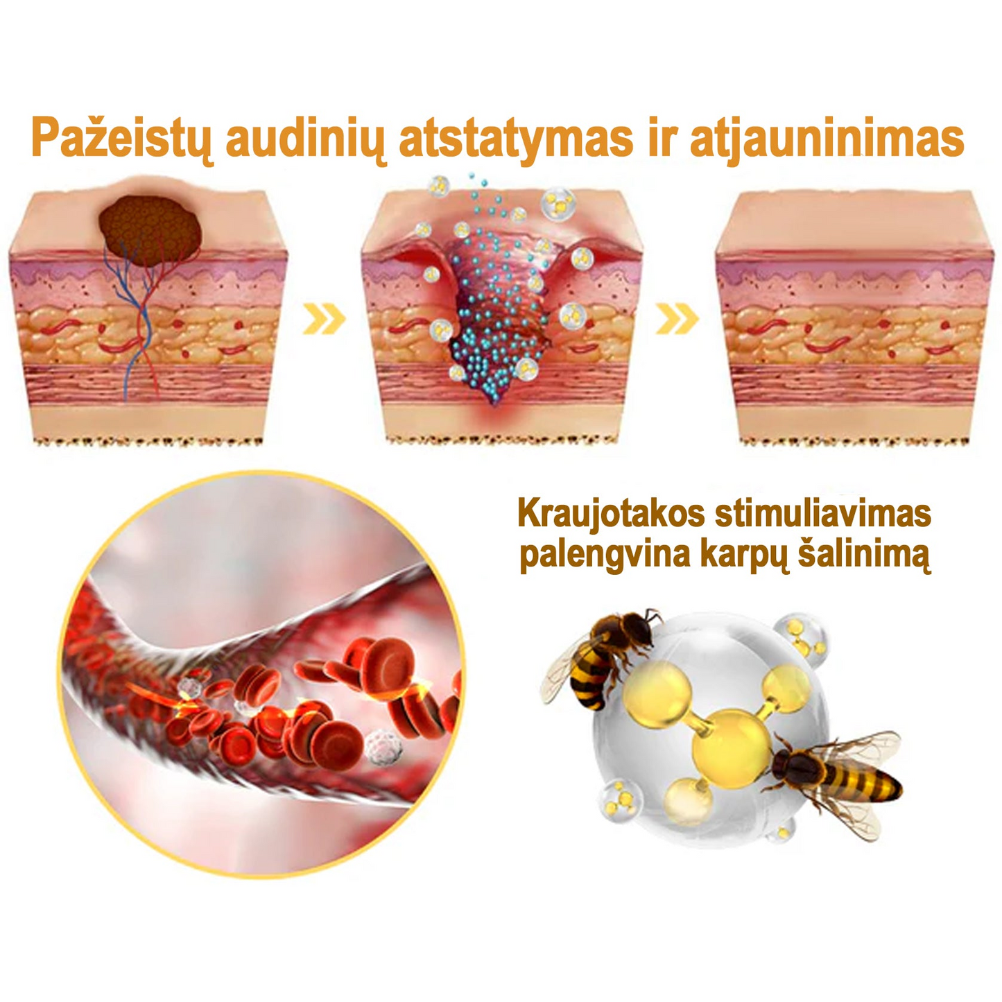 Flysmus™ ārstnieciskais bišu indes aerosols | Noņem nevēlamus ādas veidojumus 