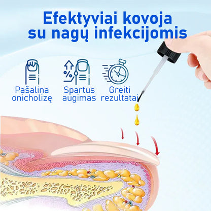 OnyxoGuard™ Atstatomasis Nagų Serumas | Atstato, Stiprina Ir Skatina Augimą