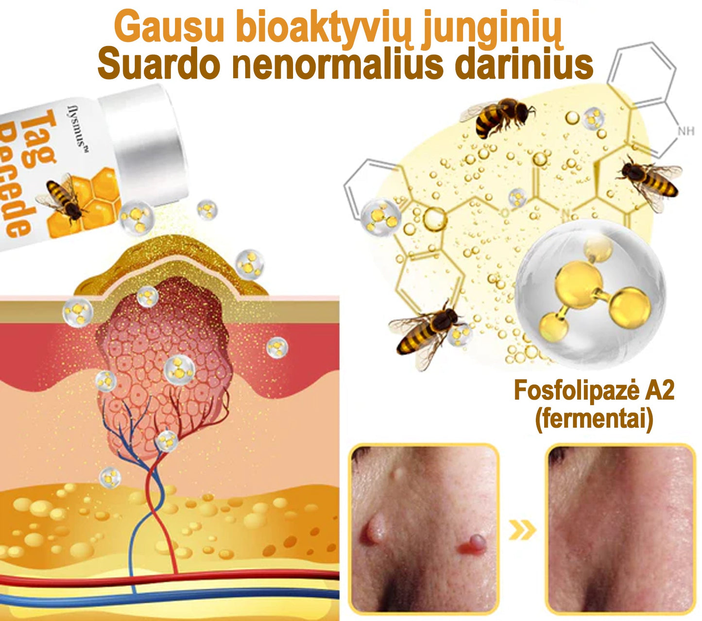 Flysmus™ terapeutiline mesilasmürgi pihusti | Eemaldab soovimatud nahakasvud 